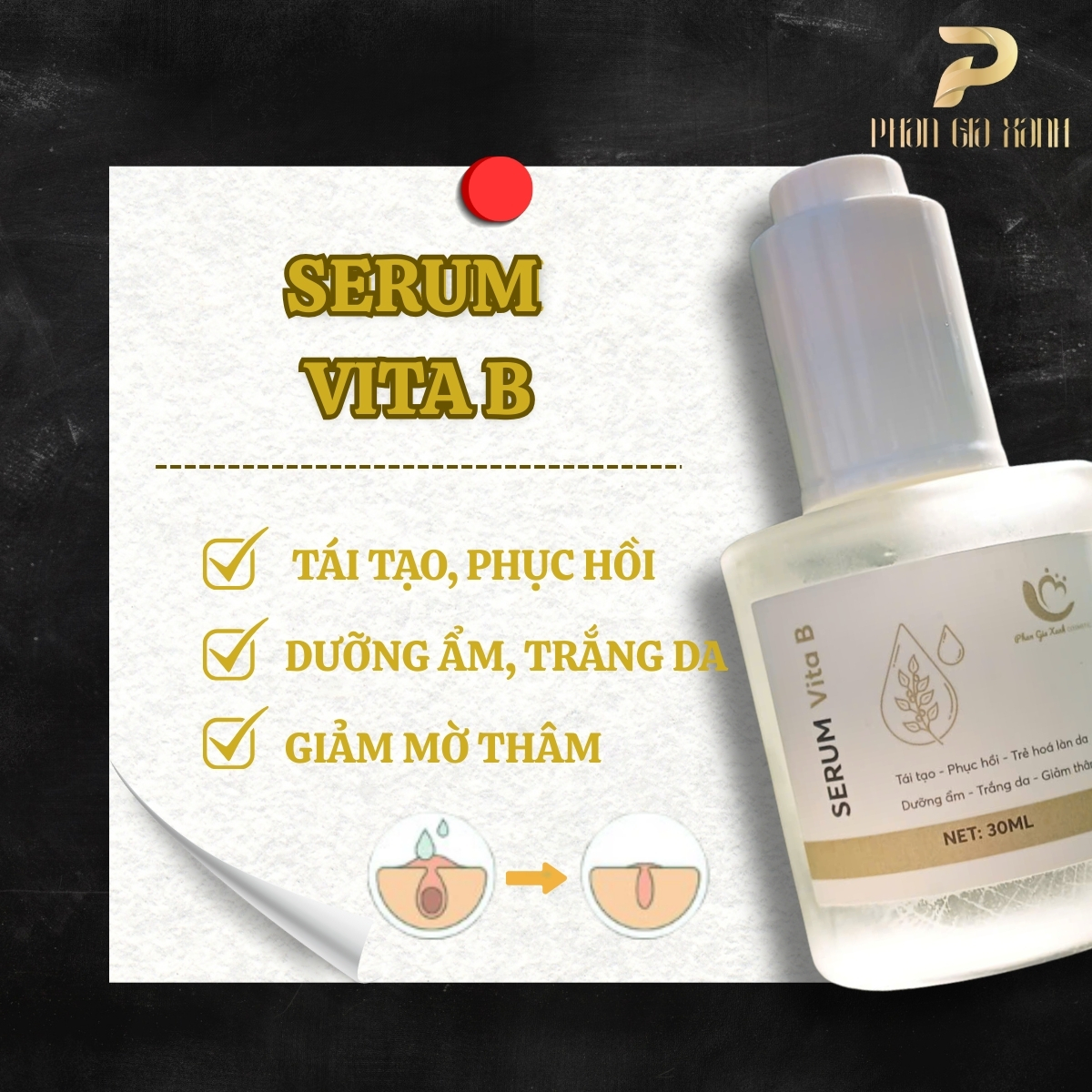 Serum Vita B 1 Serum Vita B
